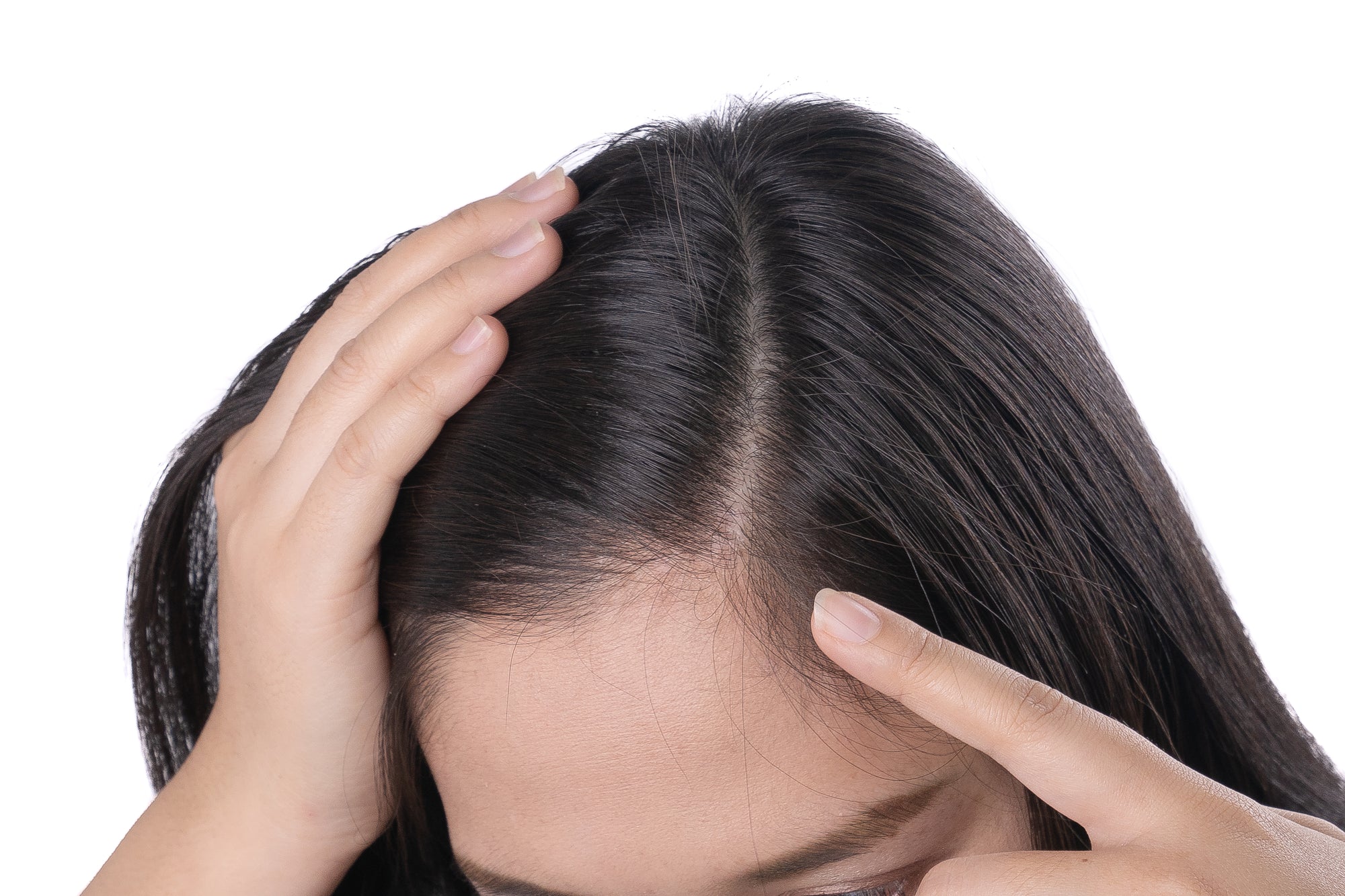 Essential Oils for Thinning Hair